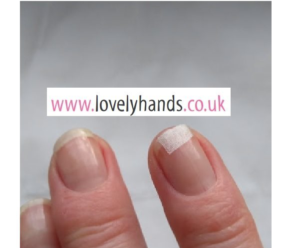 Why do my nails split? What can I do to treat nail splits successfully? -  Lovely Hands